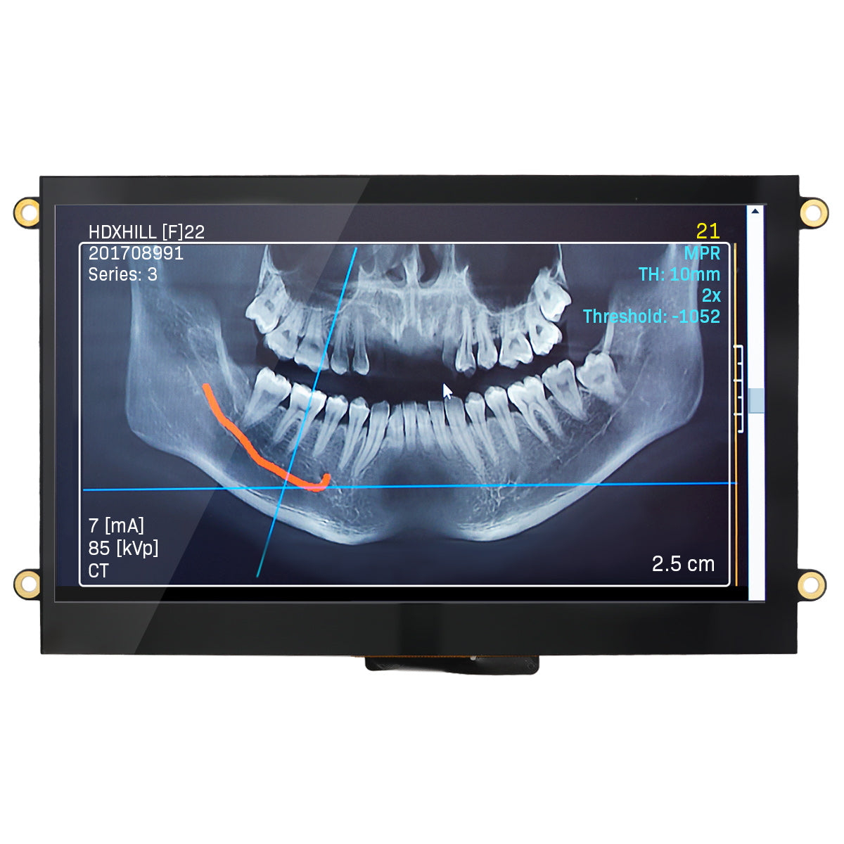 NHD-7.0-800480FT-CSXP-CTP